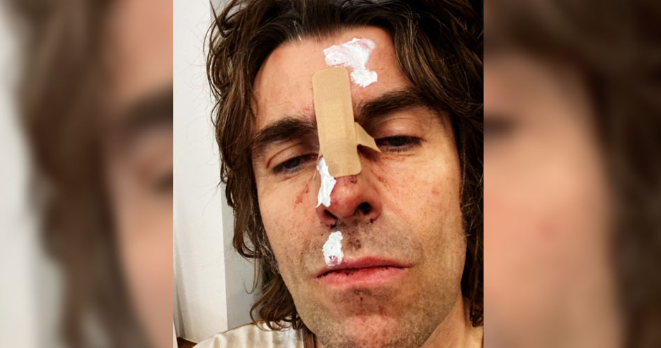 Liam Gallagher diz ter sofrido queda de helicóptero